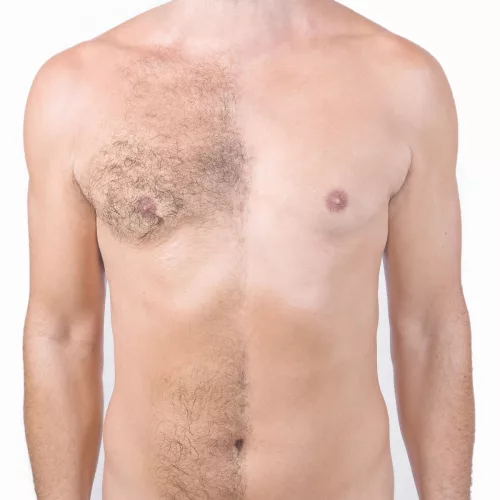 Intome - intim szőrtelenítő por (70 g) - Bio és natúr intim termékek