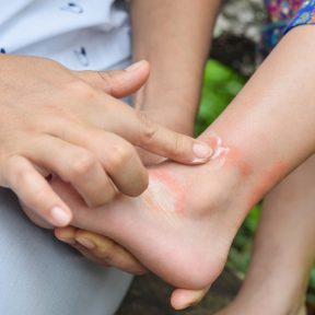 Gyógy- és sportkrém